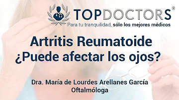 ¿Puede la artritis afectar a los ojos?