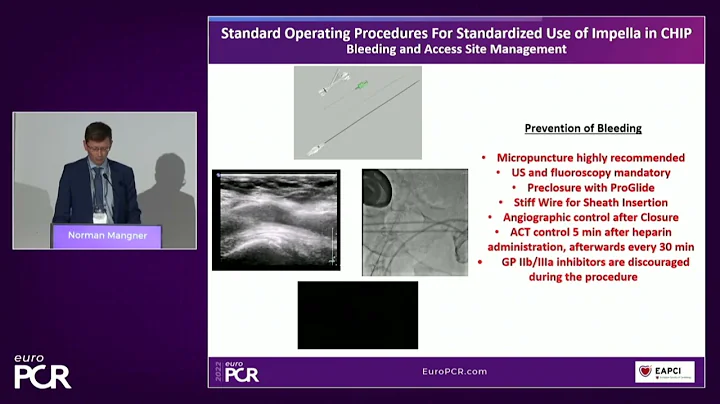 Tailored support for complex PCI and AMI with percutaneous mechanical circulatory support
