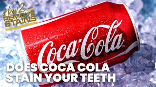 Does coca cola stain your teeth ?