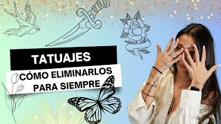 ✒️TATUAJES: CÓMO ELIMINARLOS PARA SIEMPRE✒️