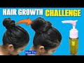 7 Days Hair Growth Challenge - बाल की हर समस्या का 100% इलाज Anagen सिर्फ 1 Ingredient ( Onion ) से