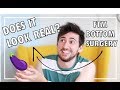 FTM BOTTOM SURGERY || Your Questions Answered