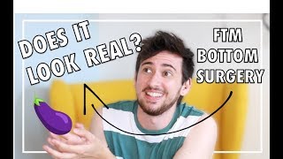 FTM BOTTOM SURGERY || Your Questions Answered