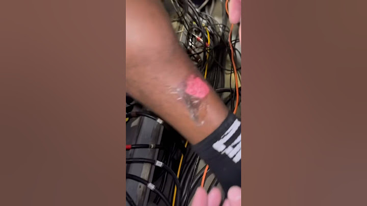 IShowSpeed Hurts Himself After Getting Eliminated From WWE Mens Royal Rumble Match😮 #wwe #speed