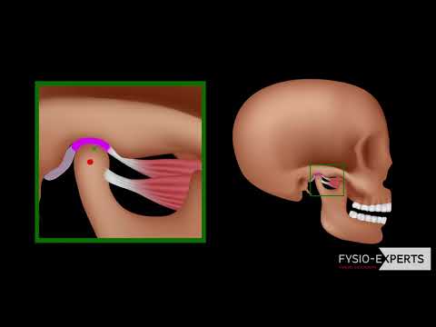 Video: Gebroken Of Ontwrichte Kaak: Oorzaken, Symptomen En Diagnose