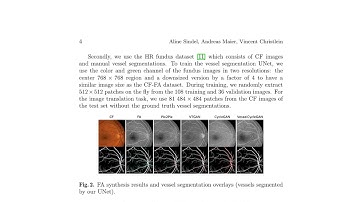 A Vessel-Segmentation-Based CycleGAN for Unpaired Multi-modal Retinal Image Synthesis -