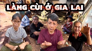 Làng Cùi Gia Lai, Xót Xa Những Mảnh Đời Bất Hạnh, Mang Căn Bệnh Quái Ác, Bệnh Phong Cùi