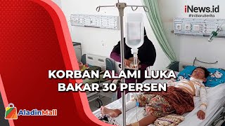 Gara-Gara Petasan Spiritus, Bocah Terbakar di Subang