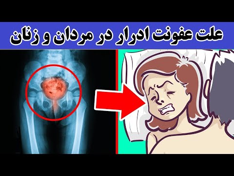 علت عفونت ادرار و نشانه های آن