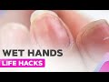 Manicure Life Hacks | Hyperhidrosis | Multiple Hangnails