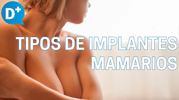 ¿Existe un implante mamario natural?