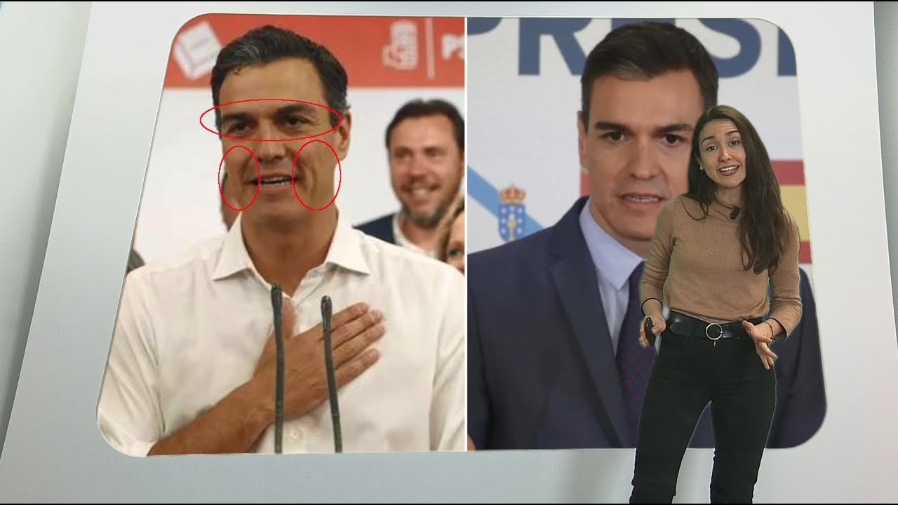 Pedro Sánchez: ¿se ha hecho retoques en la cara?