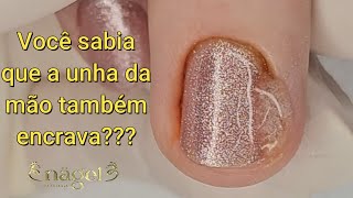 ?O QUE SERÁ QUE ESSA UNHA LINDA ESCONDE | Procedimento na mão satisfying viral