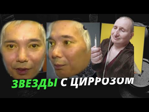 ОСТОРОЖНО- ЦИРРОЗ ПЕЧЕНИ КАК УМИРАЛИ ОТ ЦИРРОЗА ЗНАМЕНИТОСТИ .ОЛЕГ ЯКОВЛЕВ, КАТЯ ОГОНËК .