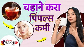 चेहऱ्यावरील पिंपल्स जाण्यासाठी घरगुती उपाय | How To Remove Pimples Overnight | Lokmat Sakhi