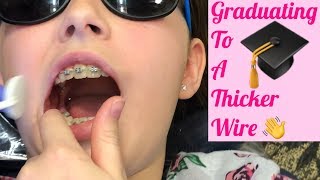 11th Braces Visit || Unexpected: Thicker Wire Repair