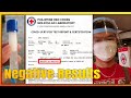 RED CROSS COVID-19 SALIVA TEST (2021)｜Paano Mag Book Online?