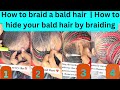 How to braid a bald head for the holiday season | How to hide your bald hair by braiding