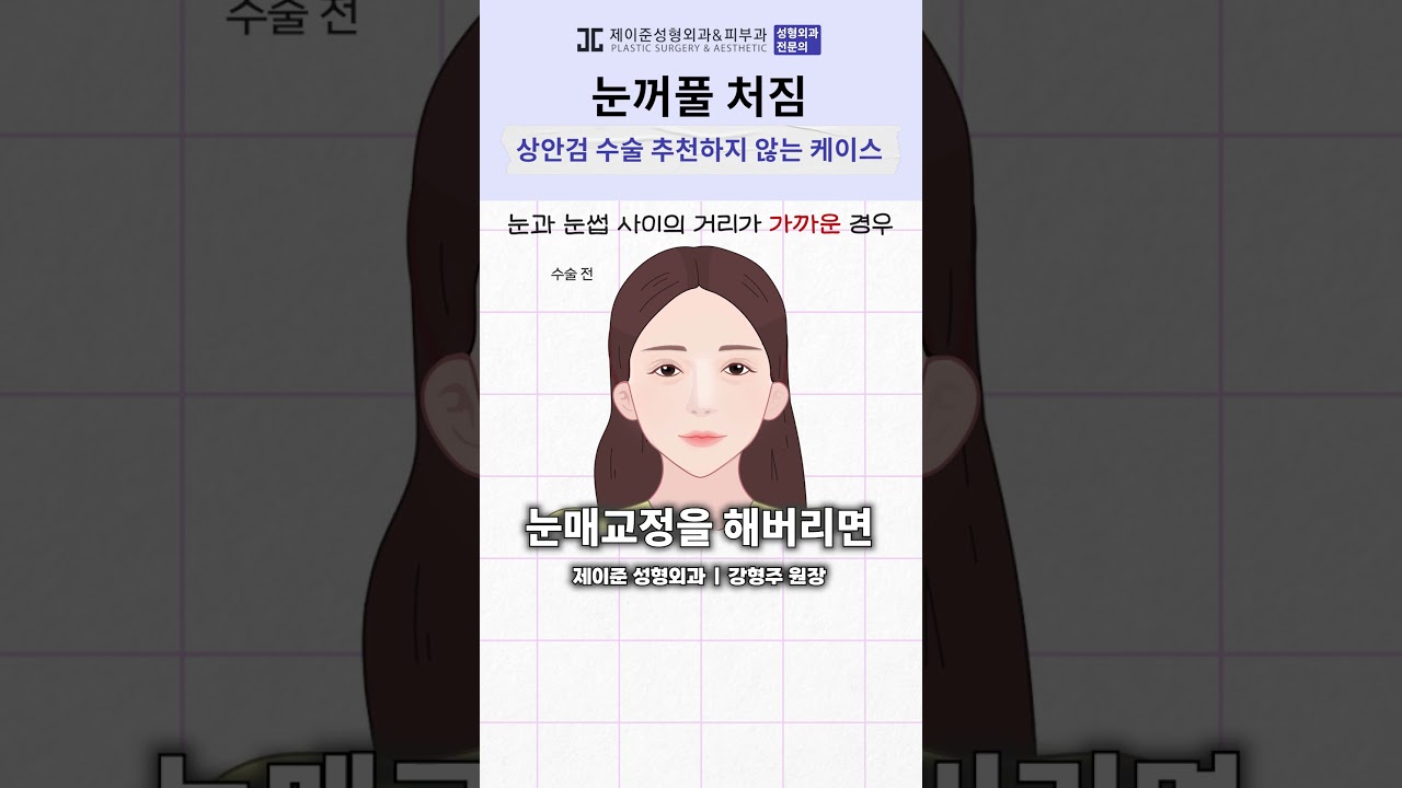[JAYJUN Phẫu thuật thẩm mỹ Da liễu] Những người này không nên phẫu thuật mí mắt trên!! #shorts