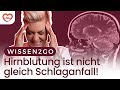 WIE ERKENNE ICH EINE HIRNBLUTUNG? I DOC CARO Mp3 Song