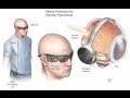 Retinal Prosthesis - Mayo Clinic
