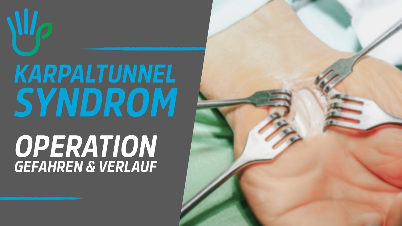 Karpaltunnelsyndrom Ab Welchem Wert Op www.youtube.com