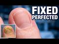 She Was Too Embarrassed to Show Her Feet... Until Now 🦶❤️ | Thick Toenails & Foot Care