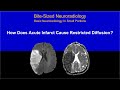 DWI - How Does Acute Infarct Cause Restricted Diffusion?