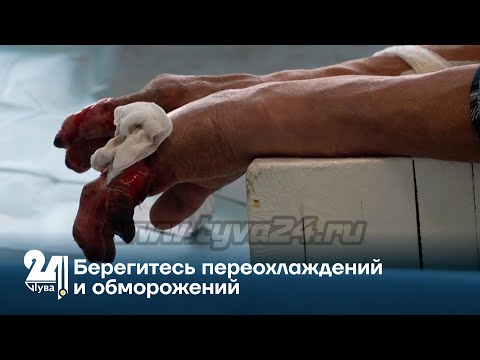 Берегитесь переохлаждений и обморожений