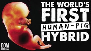 How Scientists Made the World&#39;s First Human-Pig Hybrid