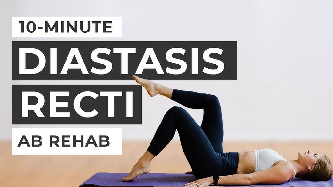 5-MINUTE DIASTASIS RECTI EXERCISES: 5-Day Workout Program to fix Diastasis  Recti, Heal Abdominal separation and close your Postpartum Gap.