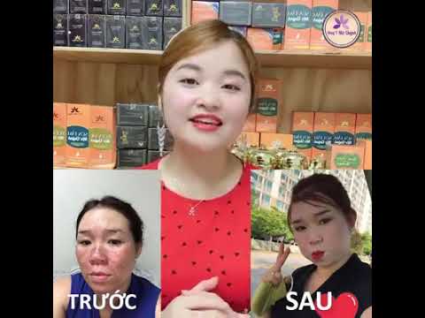 ĐIỀU TRỊ CHUYÊN SÂU NÁM TÀN NHANG _ ĐÔNG Y MỘC QUỲNH