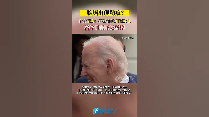 脸颊出现勒痕？白宫证实：拜登在使用呼吸机治疗睡眠呼吸暂停。#东南卫视 #最热门 - 天天要闻