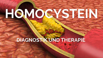 In welchen Lebensmitteln ist Homocystein?