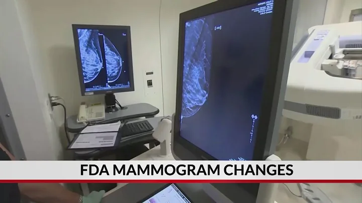 FDA proposes changes to mammogram standards for first time in decades