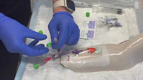 How to Flush a PICC Line | Wilmot Cancer Institute