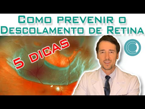 Como prevenir o descolamento de retina ? - 5 DICAS