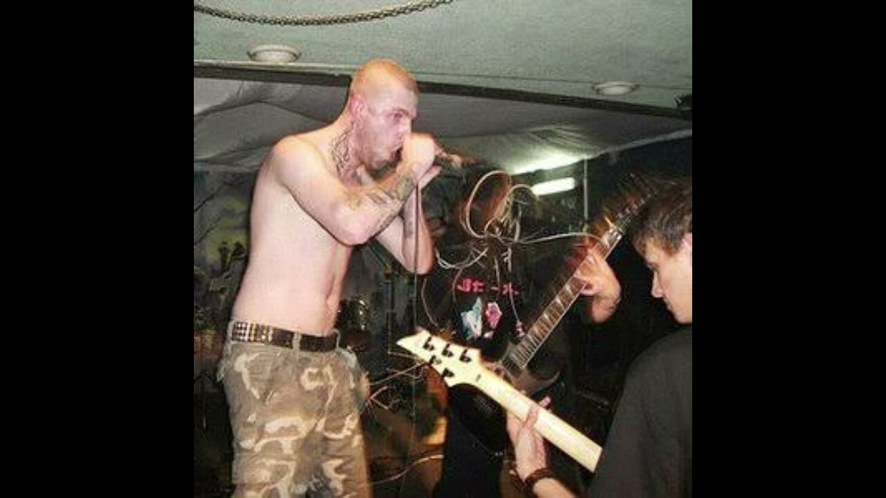 Синдром живого трупа - ROCK IS GAY