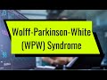 Wolff-Parkinson-White (WPW) Syndrome