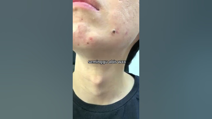 Cobain Waxing Jenggot, setelah 3 minggu jadi apa ya? 🤔😳