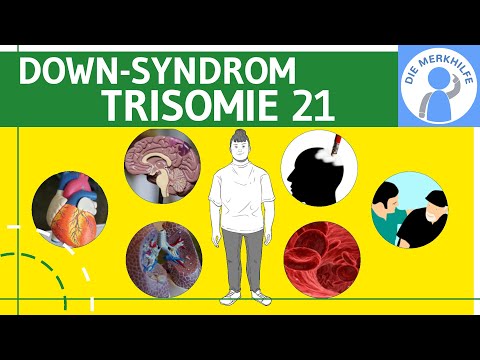 Down Syndrom / Trisomie 21 - Definition, Merkmale, Ursachen & Formen & Unterscheidungen - Genetik @diemerkhilfe