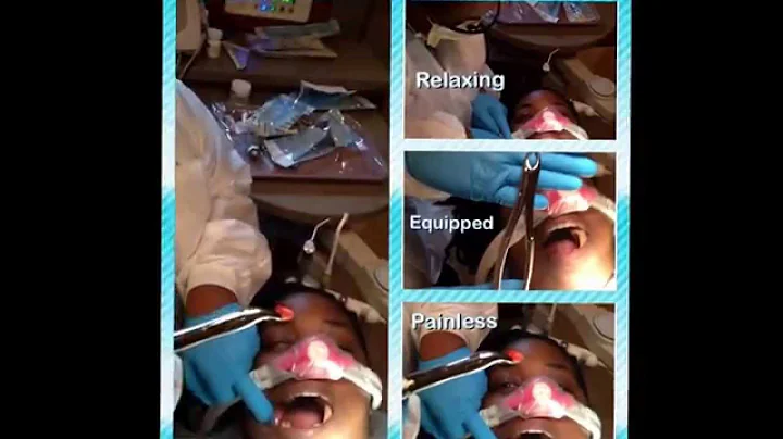 Relaxed Tooth Extraction at Dental Expression, PLLC