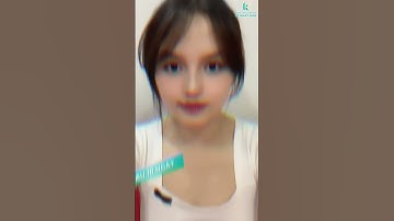 Hành Trình Lột Xác Sau 15 Ngày Phẫu Thuật Mũi Môi Dị Tật