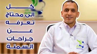 كل المعلومات عن جراحات السمنة (تكميم المعدة،الساسي، بالون المعدة)