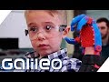 Der Junge mit der selbstgebauten Prothese | Galileo | ProSieben