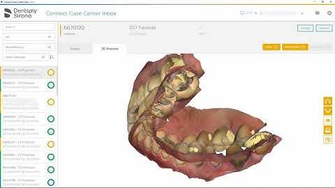 Workflow von Connect Case Center Inbox zu 3Shape: Vollkonturkronen und Onlays