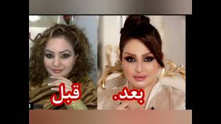 فنانات عراقيات قبل وبعد التجميل