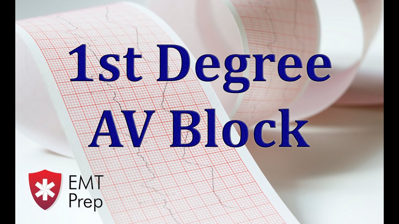 1st Degree Av Block Ecg Emtprep Com Youtube