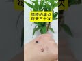Ease Low Back Pain Naturally with Chinese Massage Techniques