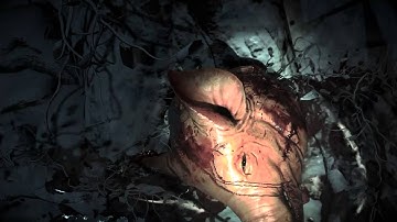 Until Dawn Extended Edition Part #2 German